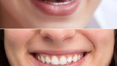 Photo of What Your Teeth Say About Your Personality