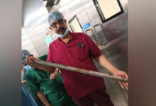 Photo of KMC Doctors Remove Metal Rod from Patient’s Chest